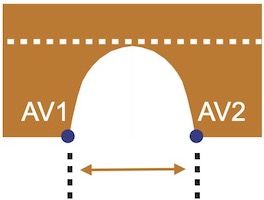 Distance AV1 AV2